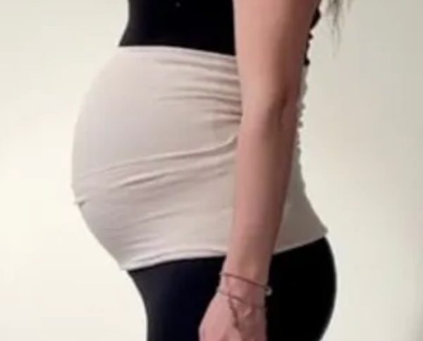 Maternity tubigrip